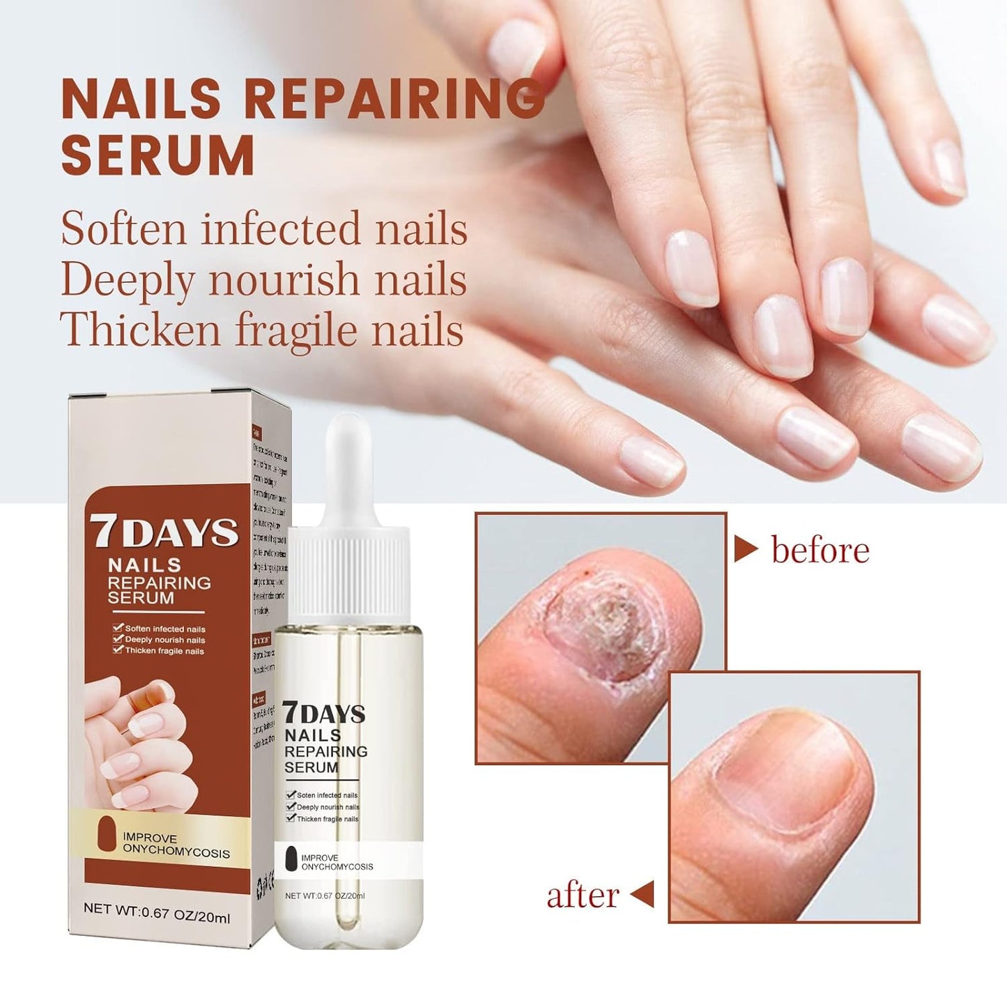 Copy of 7 Days nails repairing Serum