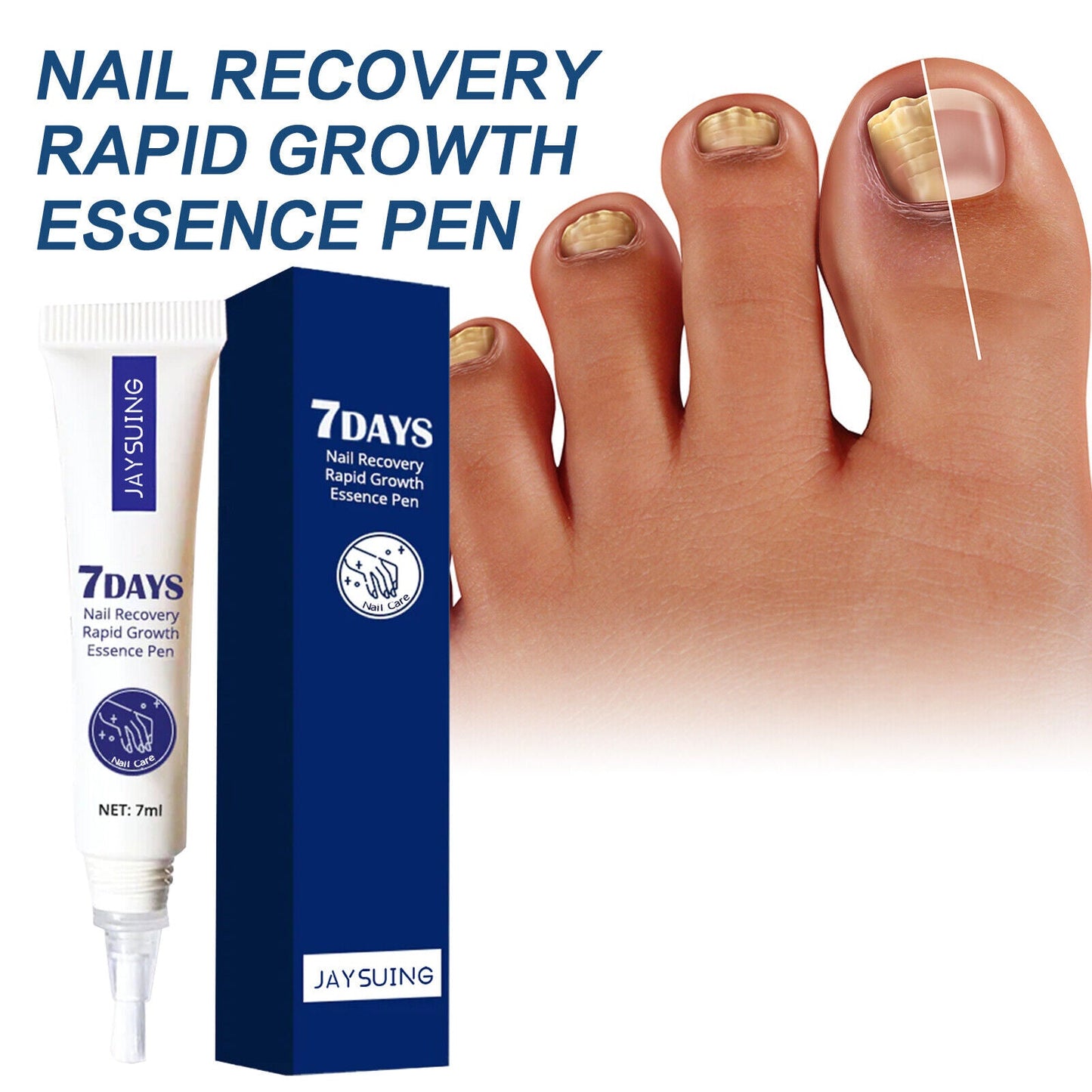 7 Days Nail Recovery Rapid Growth Essence Pen