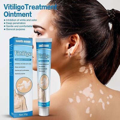 Original™ TreatVitiligo Soothing Cream